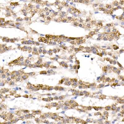 Immunohistochemistry-Paraffin: CYP11B1 Antibody - BSA Free [NBP3-04876]